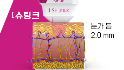 아이슈링크 (핑크팁)